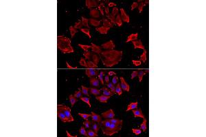 Immunofluorescence analysis of HeLa cell using TCAP antibody. (TCAP antibody)