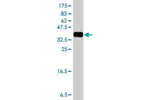 Western Blot detection against Immunogen (36. (TIAM2 antibody  (AA 527-624))