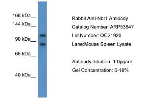 WB Suggested Anti-Nbr1  Antibody Titration: 0. (NBR1 antibody  (C-Term))