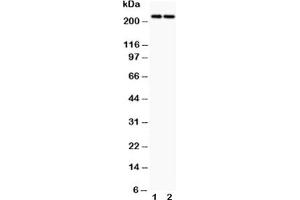 Western blot testing of Dicer antibody and Lane 1:  HeLa;  2: MCF-7 (DICER1 antibody  (AA 1-195))