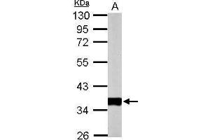 WB Image Sample (50 ug of whole cell lysate) A: mouse heart 10% SDS PAGE antibody diluted at 1:10000 (PDHE1-B antibody)