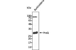 Western Blotting (WB) image for anti-ProQ antibody (ABIN7272983) (ProQ antibody)