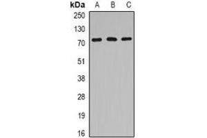Western blot analysis of HSPA6 expression in Jurkat (A), mouse heart (B), rat brain (C) whole cell lysates.