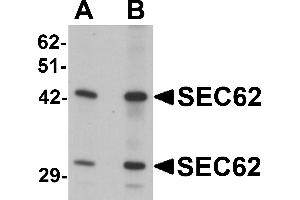 Western blot analysis of SEC62 in rat brain tissue lysate with SEC62 antibody at (A) 0.