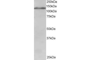 ABIN185009 staining (1µg/ml) of Jurkat lysate (RIPA buffer, 30µg total protein per lane). (USP11 antibody  (C-Term))