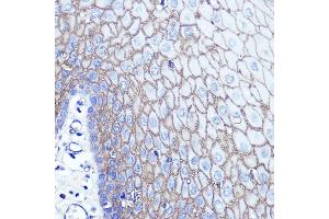 Immunohistochemistry of paraffin-embedded human esophageal using S100 Rabbit pAb (ABIN6128693, ABIN6147339, ABIN6147340 and ABIN6214636) at dilution of 1:100 (40x lens).