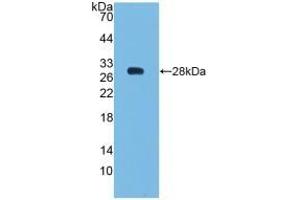 Detection of Recombinant Bcl2, Human using Polyclonal Antibody to B-Cell Leukemia/Lymphoma 2 (Bcl2) (Bcl-2 antibody  (AA 2-211))
