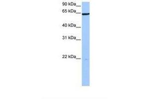 Image no. 1 for anti-PAX Interacting (With Transcription-Activation Domain) Protein 1 (PAXIP1) (AA 248-297) antibody (ABIN6738771) (PAXIP1 antibody  (AA 248-297))