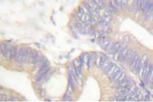 Image no. 1 for anti-Somatostatin (SST) antibody (ABIN271820) (Somatostatin antibody)