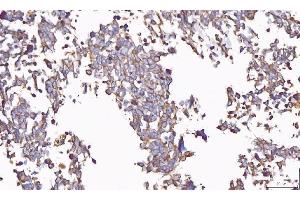 IHC analysis of PP11/ENDOU using anti-PP11/ENDOU antibody (ABIN7600552). (ENDOU antibody  (AA 20-386))