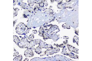 IHC analysis of splicing factor 1 using anti-splicing factor 1 antibody . (Splicing Factor 1 antibody  (AA 160-266))