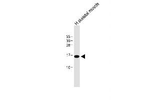 Anti-E Antibody (N-term) at 1:500 dilution + Human skeletal muscle lysate Lysates/proteins at 20 μg per lane. (EMP1 antibody  (N-Term))