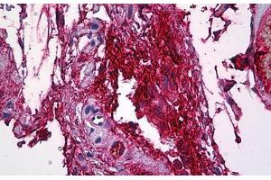 Human Intravascular Plasma: Formalin-Fixed, Paraffin-Embedded (FFPE) (FGG antibody  (AA 31-130))