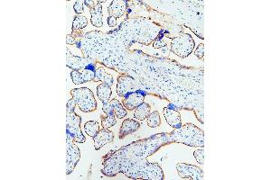 IHC analysis of EGFR using anti-EGFR antibody (ABIN5518909). (EGFR antibody  (N-Term))