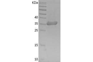 Western Blotting (WB) image for Glyceraldehyde-3-Phosphate Dehydrogenase (GAPDH) (AA 2-335) protein (His tag) (ABIN7281629) (GAPDH Protein (AA 2-335) (His tag))
