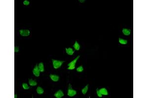 Immunofluorescence of monoclonal antibody to PHB on HeLa cell. (Prohibitin antibody  (AA 1-272))