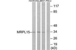 Western Blotting (WB) image for anti-Mitochondrial Ribosomal Protein L15 (MRPL15) (AA 191-240) antibody (ABIN2890049) (MRPL15 antibody  (AA 191-240))