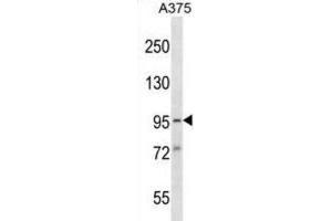 Western Blotting (WB) image for anti-Synapse Defective 1, rho GTPase, Homolog 1 (SYDE1) antibody (ABIN2998825) (SYDE1 antibody)