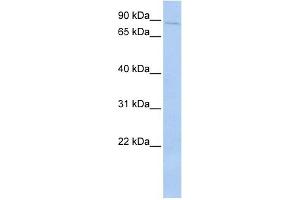 PRKRIR antibody used at 1 ug/ml to detect target protein. (PRKRIR antibody)