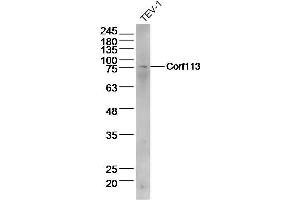 Lane 1: Tev-1 lysates probed with C1orf113 Polyclonal Antibody  at 1:300 overnight at 4˚C. (SH3D21 antibody  (AA 51-150))