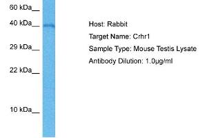 Host: Mouse Target Name: CRHR1 Sample Tissue: Mouse Testis Antibody Dilution: 1ug/ml (CRHR1 antibody  (C-Term))
