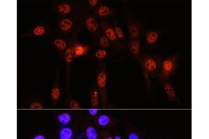 Immunofluorescence analysis of NIH-3T3 cells using Phospho-YAP1(S127) Polyclonal Antibody at dilution of 1:100 (40x lens). (YAP1 antibody  (pSer127))