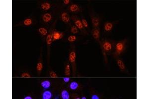 Immunofluorescence analysis of NIH-3T3 cells using Phospho-YAP1(S127) Polyclonal Antibody at dilution of 1:100 (40x lens).