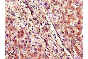 Immunohistochemistry (IHC) image for anti-Solute Carrier Organic Anion Transporter Family, Member 1B3 (SLCO1B3) (AA 648-695) antibody (ABIN7170291)