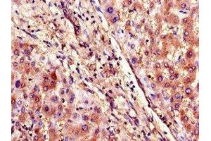 Immunohistochemistry of paraffin-embedded human liver tissue using ABIN7170291 at dilution of 1:100 (SLCO1B3 antibody  (AA 648-695))