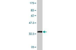 Western Blot detection against Immunogen (37. (PTK7 antibody  (AA 36-145))