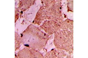 Immunohistochemical analysis of IDOL staining in human heart formalin fixed paraffin embedded tissue section. (MYLIP antibody  (Center))