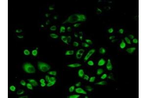 Detection of PSAP in Human Hela Cells using Polyclonal Antibody to Prosaposin (PSAP) (Prosaposin antibody  (AA 17-524))