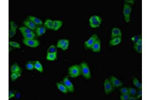 Immunofluorescent analysis of HepG2 cells using ABIN7146228 at dilution of 1:100 and Alexa Fluor 488-congugated AffiniPure Goat Anti-Rabbit IgG(H+L) (P-Cadherin antibody  (AA 117-360))