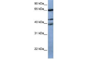 WB Suggested Anti-ZNF681 Antibody Titration:  0.