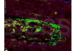 Formalin-fixed and paraffin embedded human laryngeal cancer tissue labeled with Anti-APOH Polyclonal Antibody, Unconjugated (ABIN731483) at 1:200 followed by conjugation to the secondary antibody, Goat Anti-Rabbit IgG, AF488 conjugated, and DAPI staining (APOH antibody  (AA 281-345))