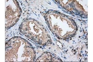 Immunohistochemistry (IHC) image for anti-Aldehyde Dehydrogenase 3 Family, Member A1 (ALDH3A1) antibody (ABIN1496591) (ALDH3A1 antibody)