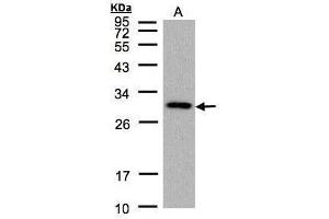 WB Image Sample (30 ug of whole cell lysate) A: 293T 12% SDS PAGE CTDSP2 antibody antibody diluted at 1:1000 (CTDSP2 antibody  (Center))