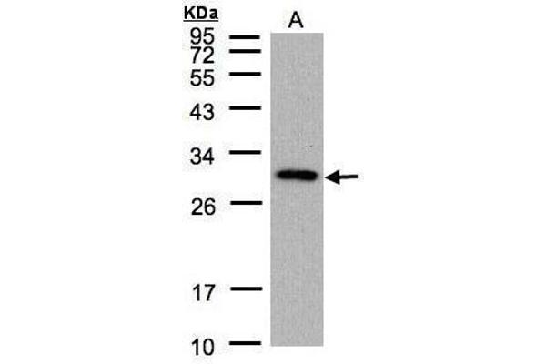 CTDSP2 antibody  (Center)