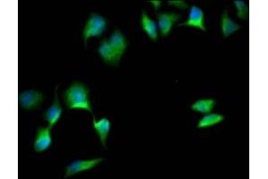 Immunofluorescence staining of Hela Cells with ABIN7127821 at 1:50, counter-stained with DAPI. (Recombinant SOX1 antibody)