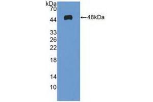Detection of Recombinant MAX, Human using Polyclonal Antibody to MYC Associated Factor X (MAX) (MAX antibody  (AA 2-160))
