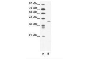 Image no. 1 for anti-Somatostatin Receptor 4 (SSTR4) (AA 163-212) antibody (ABIN202399) (SSTR4 antibody  (AA 163-212))