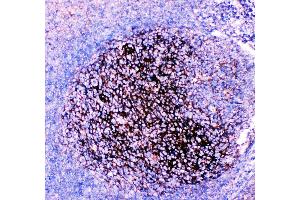 Anti-CD82 Picoband antibody, IHC(P) IHC(P): Human Tonsil Tissue (CD82 antibody  (AA 98-267))