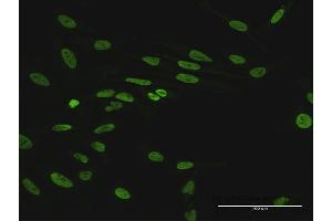 Immunofluorescence of purified MaxPab antibody to HNRNPUL1 on HeLa cell. (HNRNPUL1 antibody  (AA 1-804))