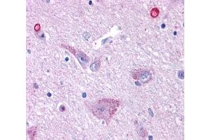 Anti-GPR50 antibody  ABIN1049060 IHC staining of human brain, hypothalamus. (GPR50 antibody  (Cytoplasmic Domain))