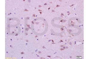 Formalin-fixed and paraffin embedded rat brain labeled with Anti-5-HTR1A/HTR1A Polyclonal Antibody, Unconjugated (ABIN738006) at 1:200 followed by conjugation to the secondary antibody and DAB staining. (Serotonin Receptor 1A antibody  (AA 301-400))