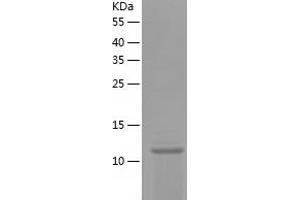 Angiopoietin 4 (ANGPT4) (AA 25-144) protein (His-IF2DI Tag)