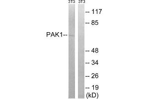 Western blot analysis of extracts from 3T3 cells, treated with UV (15mins), using PAK1 (epitope around residue 204) antibody. (PAK1 antibody  (Ser204))