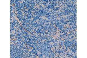 IHC-P analysis of spleen tissue, with DAB staining. (SMAD1 antibody  (AA 273-468))