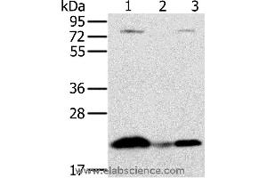 Western blot analysis of Raji cell and human liver cancer tissue, hela cell, using NDUFAF2 Polyclonal Antibody at dilution of 1:250 (NDUFAF2 antibody)