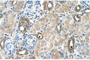 Human kidney (MGAT2 antibody  (Middle Region))